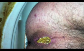 Man Smears Yellow Shit Over His Asshole