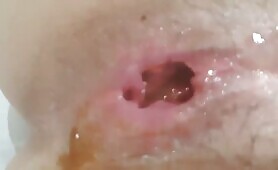 Babe Gets Fingering and Takes a Dump