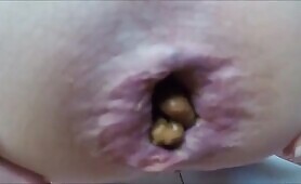 Babe Takes a Dump on Infected Cock