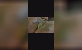 Green Foliage Covers a Nasty Dump